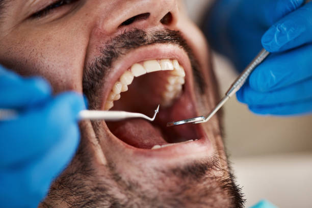 Best Emergency Treatment for Dental Infections or Abscesses in San Juan, TX