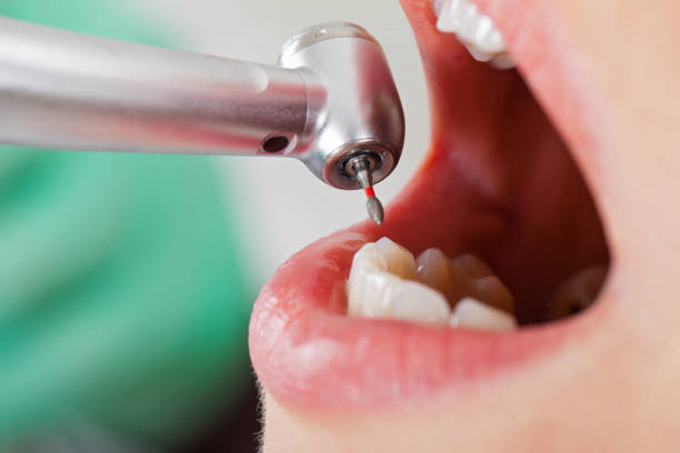 Best After-Hours Dental Trauma Care in San Juan, TX